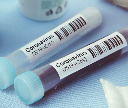 KlinicApp offers COVID-19 home tests