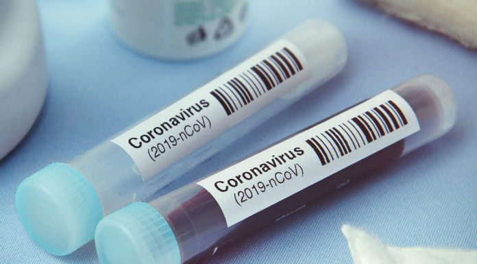 KlinicApp offers COVID-19 home tests KlinicApp offers COVID-19 home tests