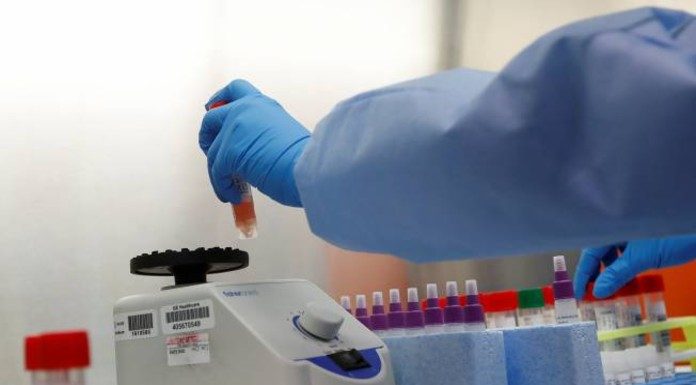 Mylab gets commercial approval for COVID-19 test kit my lab covid 19