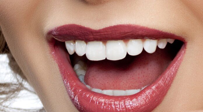 Benefits of Advanced Zoom Teeth Whitening Procedure Teeth Whitening Procedure